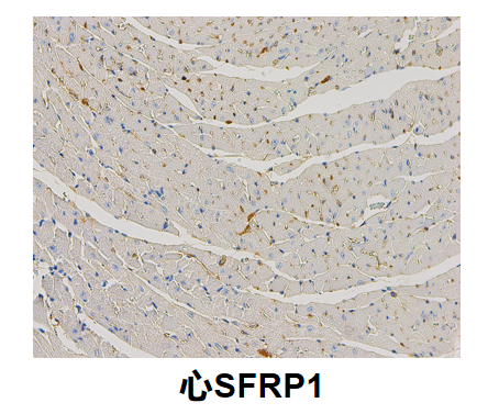 心SFRP1.png